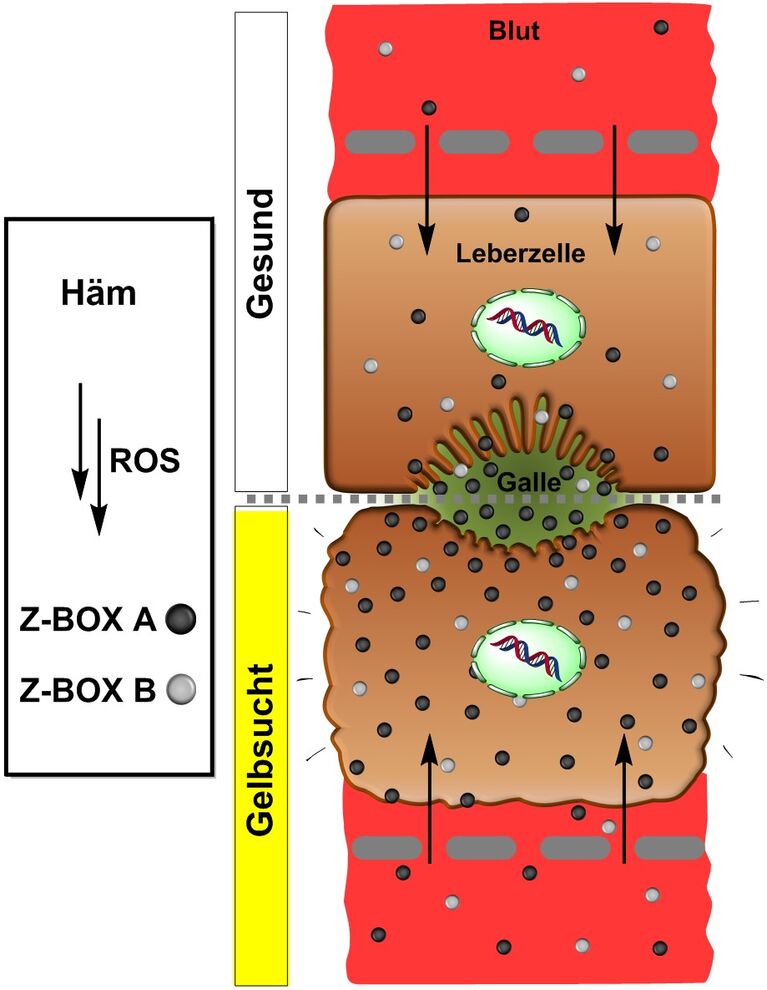 Im Gegensatz zu gesundem Lebergewebe (oben) werden bei Gelbsucht (unten) die Oxidationsprodukte Z-BOX A und Z-BOX B stark vermehrt gebildet und angereichert. Das beeinflusst die Gestalt der Leberzellen und stört die Organfunktion massiv. (Quelle: Raphael Seidel)