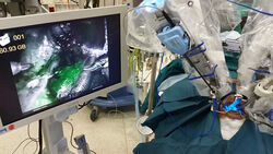 Das Anfärben von Rachen-Tumoren ermöglicht schonendere Eingriffe mit dem DaVinci-Operationsroboters am Jenaer Uniklinikum. Foto: UKJ. 
