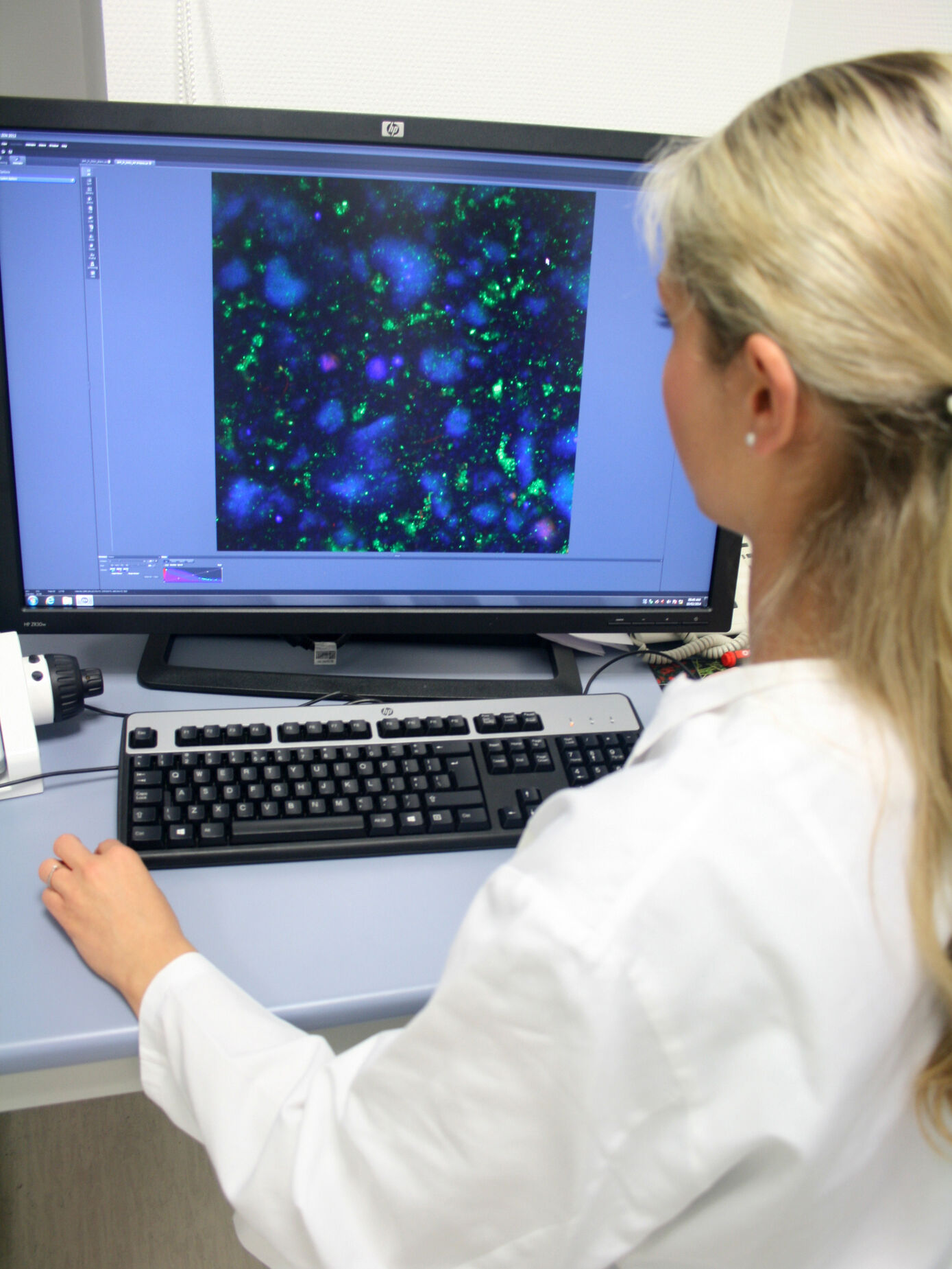 Mareike Klinger-Strobel beim Mikroskopieren der Biofilme, die mit zwei fluoreszierenden Farbstoffen gefärbt sind. Gut zu sehen ist, dass die Nanopartikel (blau) in den Biofilm vordringen. (Foto: Anke Schleenvoigt/ UKJ)
