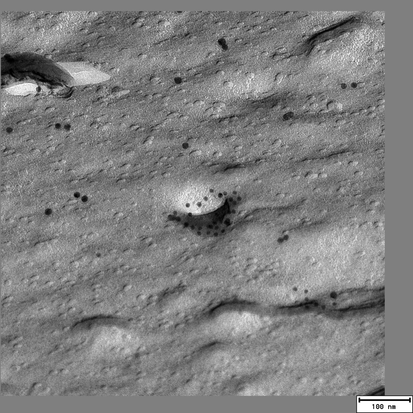 Caveole an der Innenseite der Zellmembran mit den markierten Proteinen Caveolin und Syndapin. Bildquelle: Eric Seemann/ UKJ