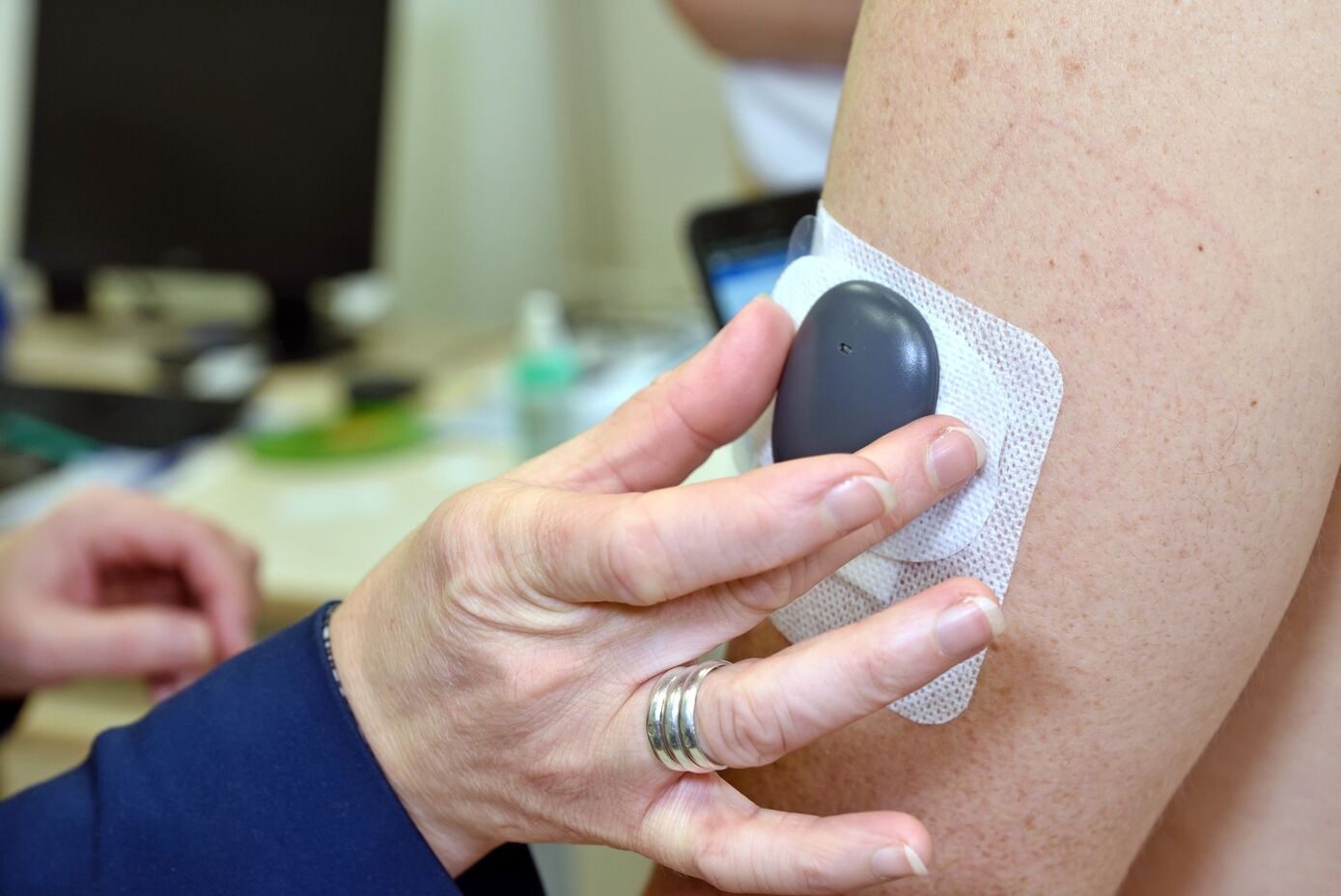 Der Glukosesensor ist als neuartiges Mess- und Frühwarnsystem zur Blutzuckerbestimmung im Einsatz und verbessert die Lebensqualität von Patienten mit Diabetes Typ 1. Foto: UKJ