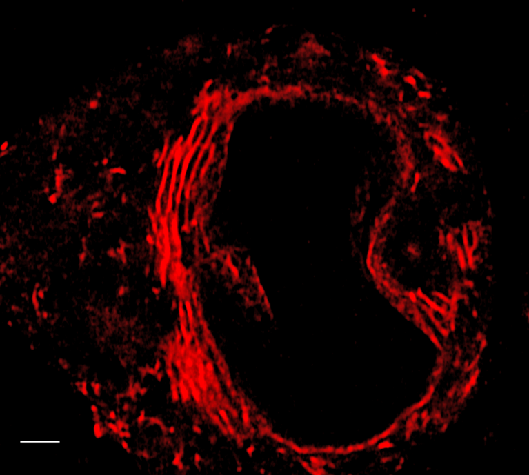 „Expansion“ Mikroskopie einer Purkinje Zelle, deren endoplasmatisches Retikulum angefärbt ist. Maßstab: 500 nm.