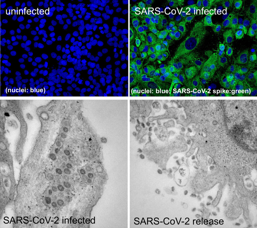 Vero-76 cells were left uninfected (top left) or  infected with 1 MOI (multiplicity of infection) SARS-CoV-2 isolate (5159) for 24 hours. Immunofluorescence microscopy (top): nuclei are stained in blue and SARS-CoV-2 spike protein is visible in green. Electronmicroscopy pictures of new produced (bottom left) and released (bottom right) virus particles. 
