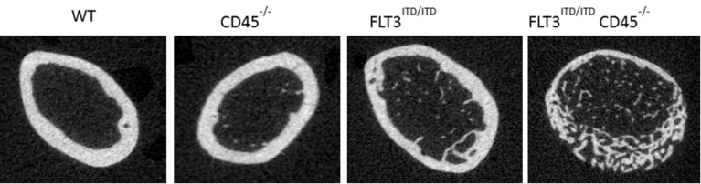 Mikro-CT-Analyse zeigt aberrante Knochenbildung in FLT3 ITD-exprimierenden Mäusen. Dargestellt sind Querschnitte durch den Oberschenkel von Mäusen mit den angegebenen Genotypen.