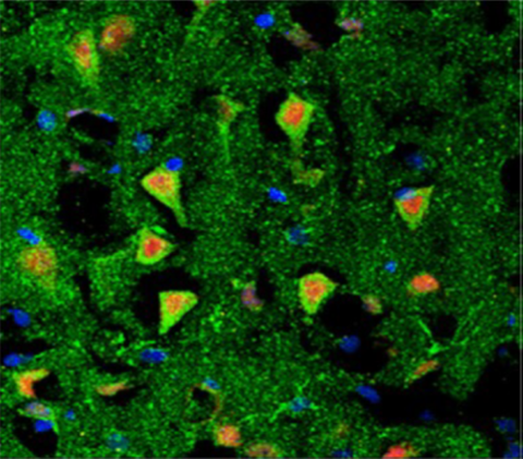 Immunolabeling of the Calcitonin gene related Peptide (CGRP) receptor in cerebral cortex of adult rats. CGRP is a neurotransmitter and increases the excitability of nerve cells in the brain, which is important e.g. for migraine headache. The CGRP receptor (stained in green) is expressed at all nerve cell bodies.