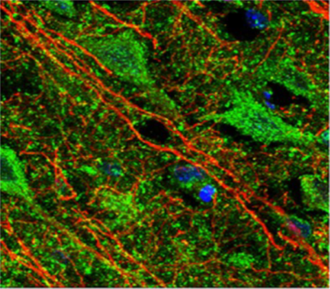 Der in Grün markierte CGRP-Rezeptor kann nicht in den Fortsätzen der Nervenzellen oder Nervenzellausläufern nachgewiesen werden. Das kann eine funktionelle Bedeutung für die Informationsübertragung durch das Neuropeptid CGRP auf die Nervenzellen haben.