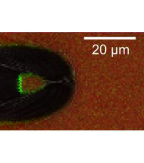 Confocal Patch-Clamp Fluorometry