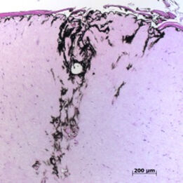 Nachweis der Tattoofarbe in einem histologischen Schnitt (HE-Färbung