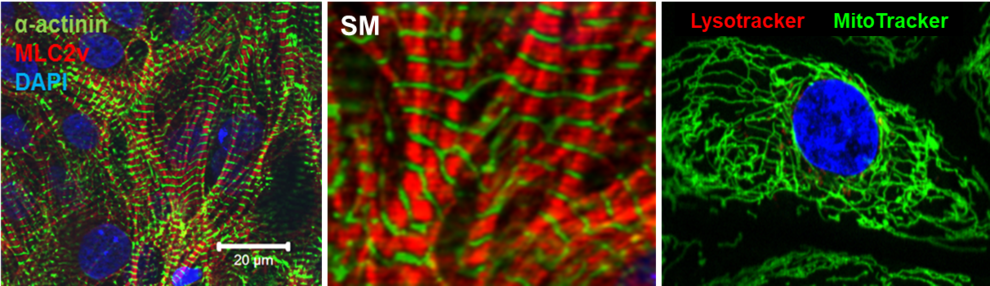 Generierung von Kardiomyozyten aus humanen iPS-Zellen mit eindeutigen Eigenschaften kardialer kontraktiler Strukturen (Bild links und Bild Mitte) sowie mitochondrialer Netzwerke (Bild rechts). 