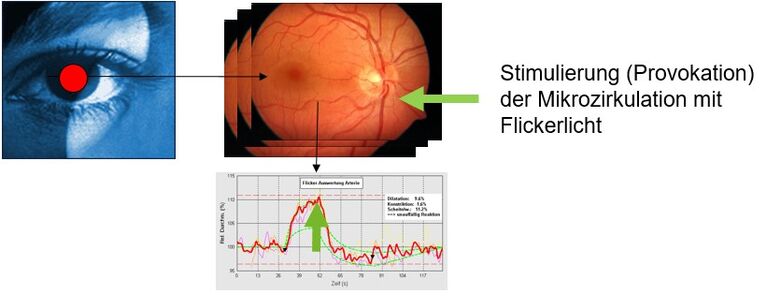 Recording of the vessel diameter and evaluation of the stimulated vascular response 