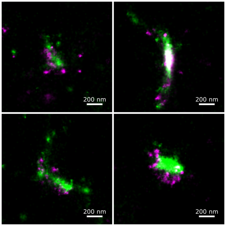 Double staining of a primary hippocampal cell culture (DIV 14) against the exitatory postsynaptic marker PSD95 and the GluN1 subunit of the NMDA receptor. 