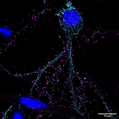 Lattice SIM image of a primary hippocampal cell culture with triple staining