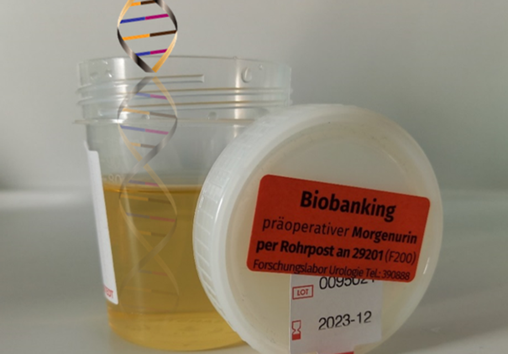 Biobanking is the basis of our research on urological tumors.