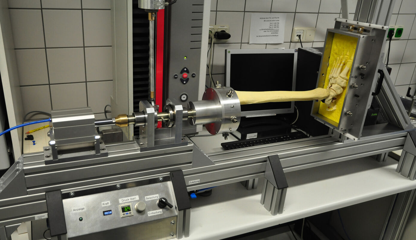 Development and construction of a device for biomechanical testing of Ankle injuries and their osteosynthetic care. The device enables ankle joints to be stressed in combination with axial forces and torsional forces and this opens up new possibilities for biomechanical testing in research. (Trauma, Hand and Reconstructive Surgery) 