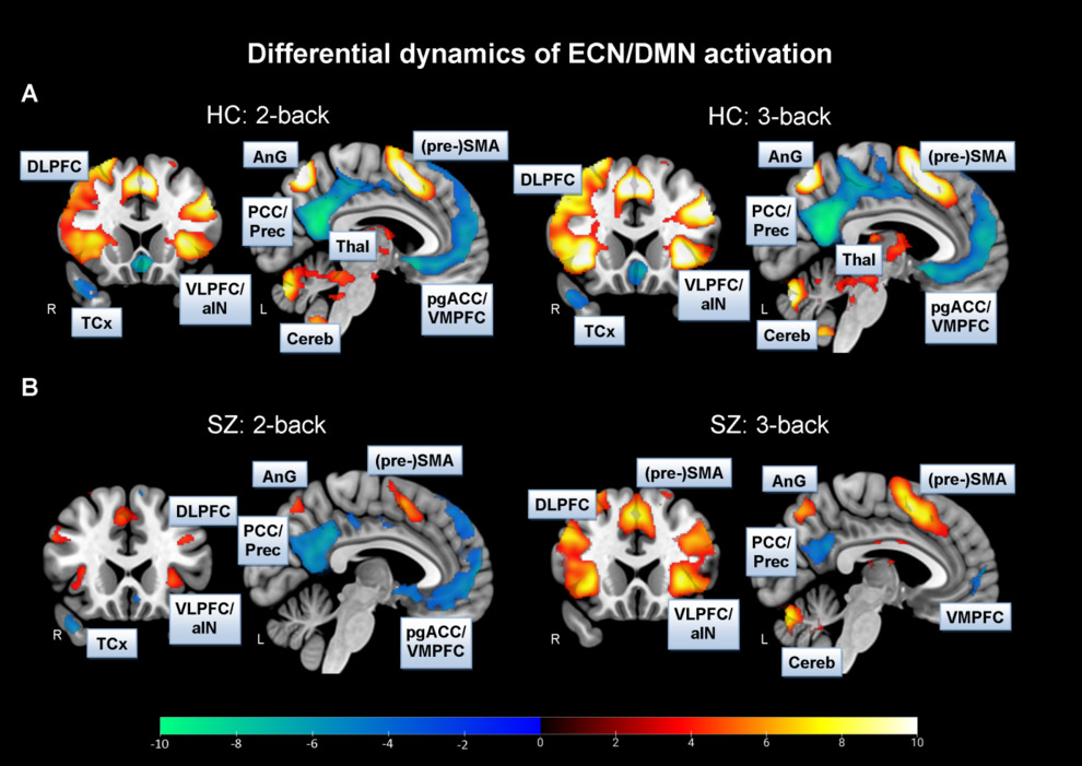 Cognitive demand induces sympathetic arousal that is associated to activation of the executive control network and deactivation of the default mode network. Patients exhibit difficulties to effectively deactivate the default mode network.