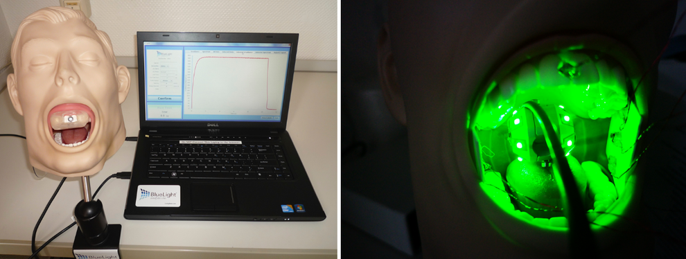 Illumination of the oral and pharyngeal region in an In-vitro patient simulator (MARC) using a LED-applicator (prototype) developed by Lucas instruments (Jena, Germany)
