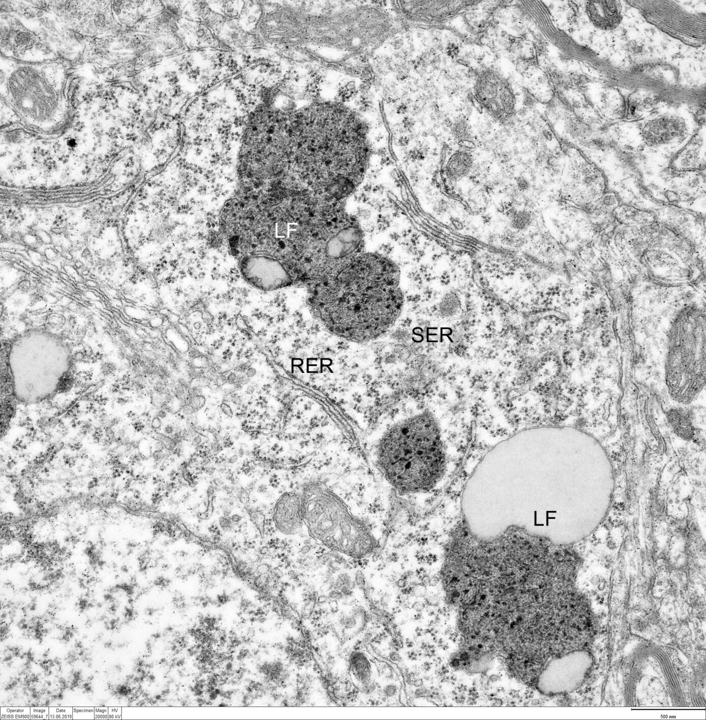 Investigation of the correlation between lipofuscin deposition (LF) and the ultrastructure of smooth (SER) and rough (RER) endoplasmic reticulum in the cytoplasm of moto neurons in the cerebral cortex of a REEP1-ko-mouse