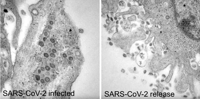 Electron micrographs of newly formed (left) and released (right) SARS-CoV-2 viruses. For this purpose, Vero-76 cells were infected with SARS-CoV-2 isolates in cell culture.