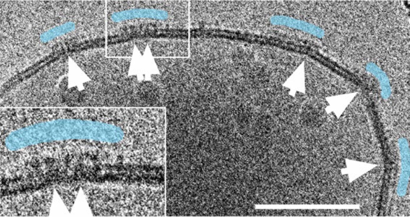 Cryo-EM investigation of liposomes containing ankycorbin1-252. Cryo-EM reveals membrane-associated ankycorbin1-252 as patches of electron-dense material (arrows). The structures are often located at sites with local changes in membrane curvature. (Fig. from Wolf et al., 2019, bar 100 nm).
