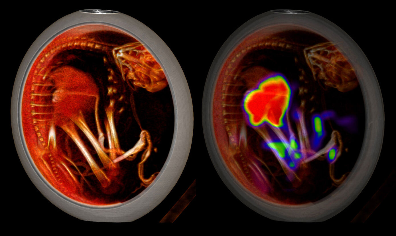 Straußenei-PET/CT-Scan 60 Minuten nach Verabreichung von [68Ga] Ga-TMeOHB-DAZA: Kontrastmittelverstärkte 3D-VRT-CT (links) und PET/CT (rechts) zeigen eine hohe Leberaufnahme
und -ausscheidung über die Galle in den Darm.