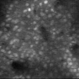 2-photon calcium imaging