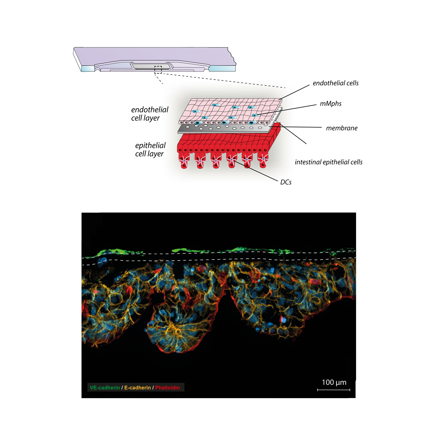 3D immunocompetent intestine-on-chip model
