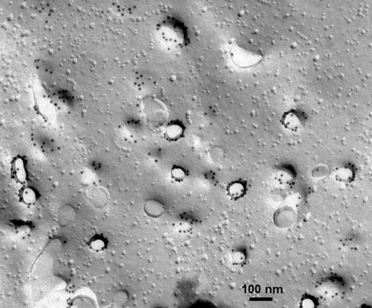 Plasmamembran einer Fibroblastenzelle (Maus) mit kleinen Einsenkungen (Caveolen). Immunogold-Markierung des Proteins Caveolin 1. Forschung zur Caveolstruktur und Entwicklung der Methodik im Elektronenmikroskopischen Zentrum.