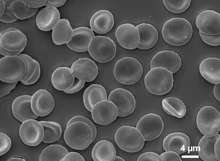 Erythrozyten im Raster-EM