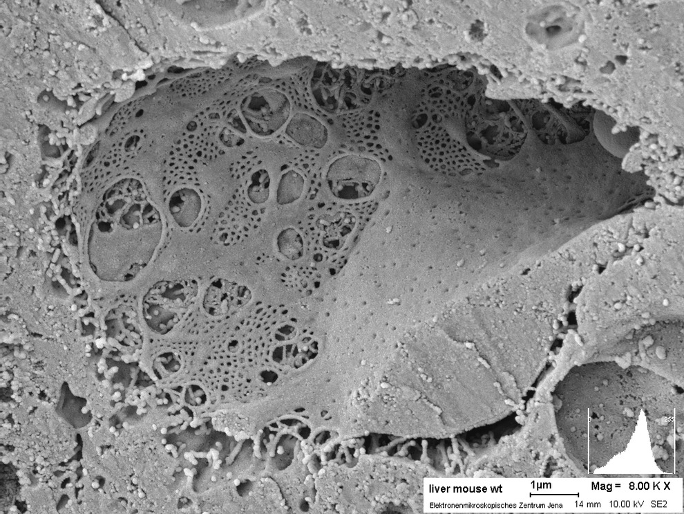 Sinusoid (Blutgefäß) mit Poren in der Leber der Maus