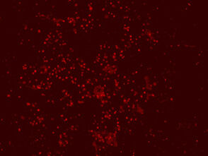 Evaluierung von Biomaterialien: Zellkultur-Test (Fluoreszenz-Mikroskopie): tot-Färbung