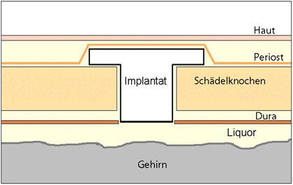 Jenaer Schädelmodell