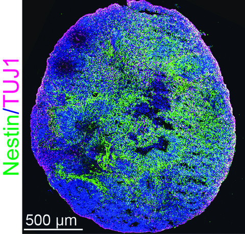 Cross-section of a brain organoid