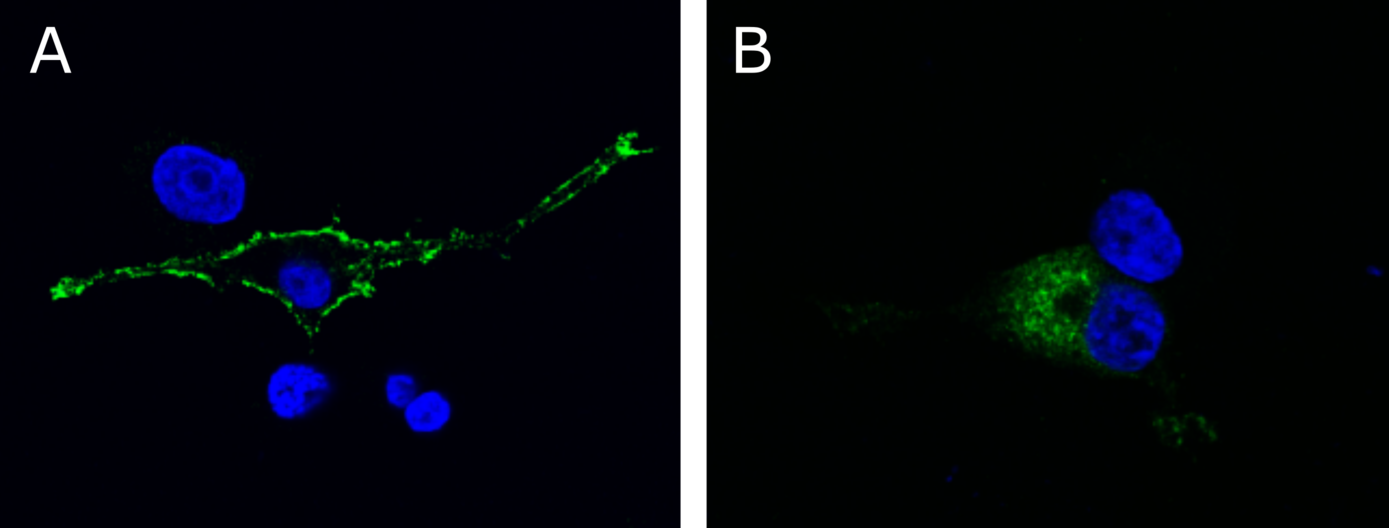 <b>Figure 5: Heterologous expression of the neurotrophin receptor NTRK1 in PC12 cells. (A)</b> Wild-type NTRK1 localizes to the plasma membrane. <b>(B)</b> The mutant receptor is trapped in the endoplasmic reticulum and is not targeted to the plasma membrane.