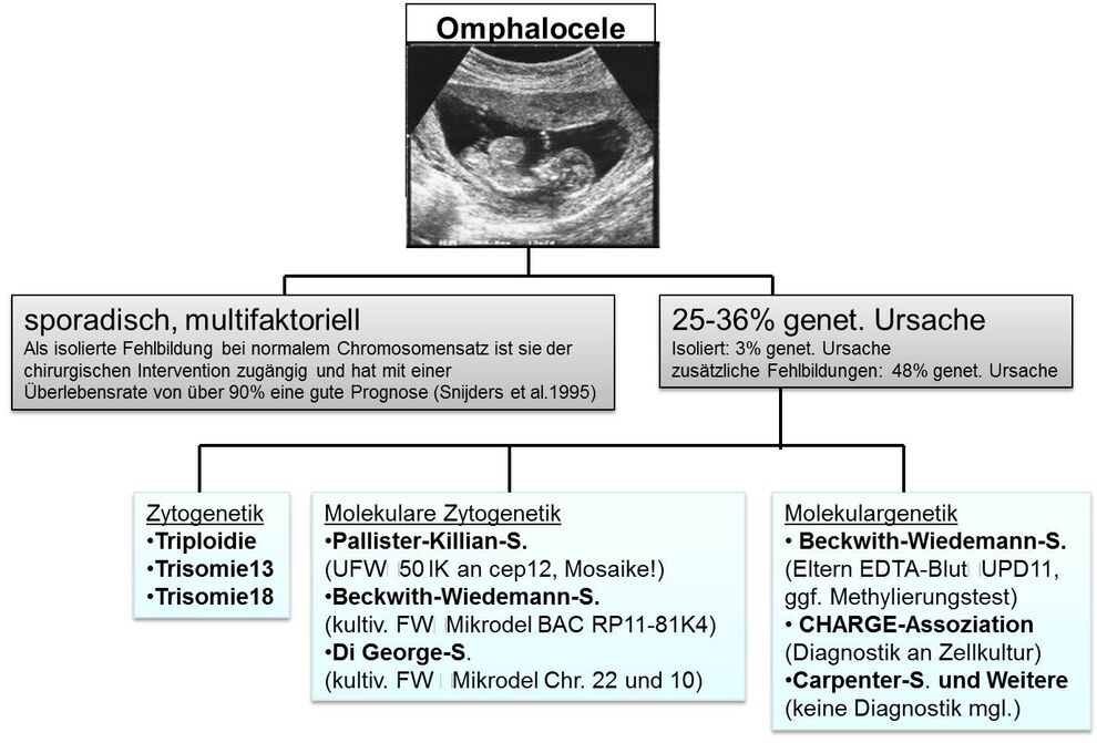 Vorschlag zur Stufendiagnostik bei fetaler Omphalocele.