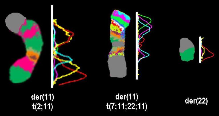 <b>Fig. 1:</b> Derivatives of chromosome 11 of the case presented in [1] depicted as pseudocolor-banding results as well as as fluorchromoprofile-results.