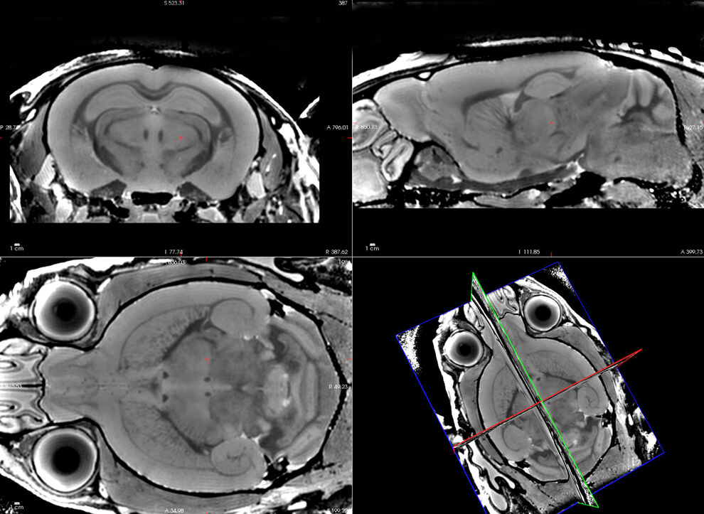 Fig. 2: High resolution (83µm isotropic), T2-weighted anatomical images of a mouse brain (fixated). From a single acquired isotropic 3D data set arbitrary slices positions can be viewed without reduced image quality.