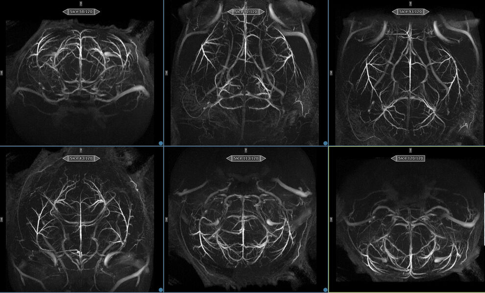 Fig. 3: 3D in vivo imaging of the arterial vessels in a mouse brain (38µm isotropic resolution). 