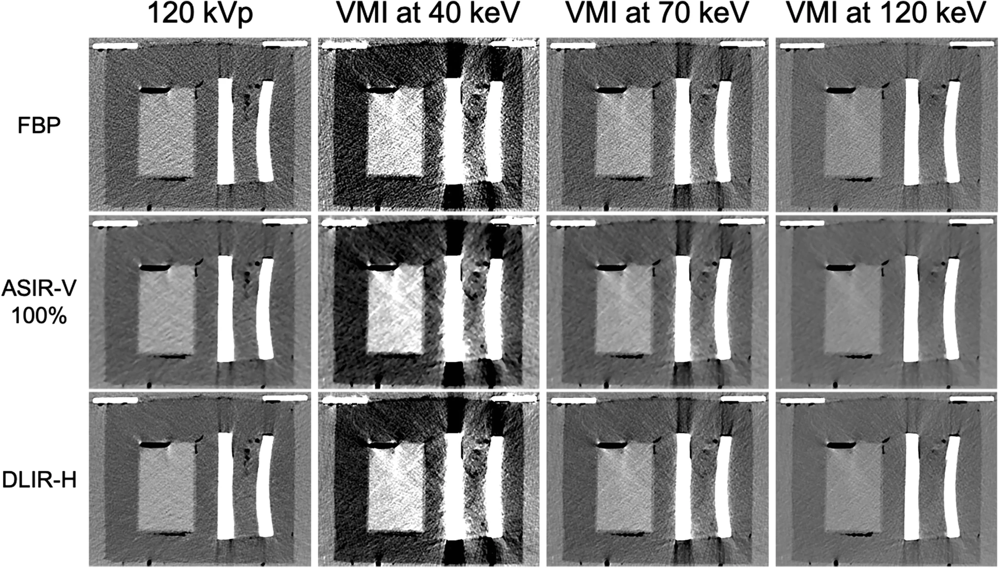 Heinrich, A. et al. CT-based thermometry with virtual monoenergetic images by dual-energy of fat, muscle and bone using FBP, iterative and deep learning–based reconstruction. Eur Radiol 32, 424–431 (2022).