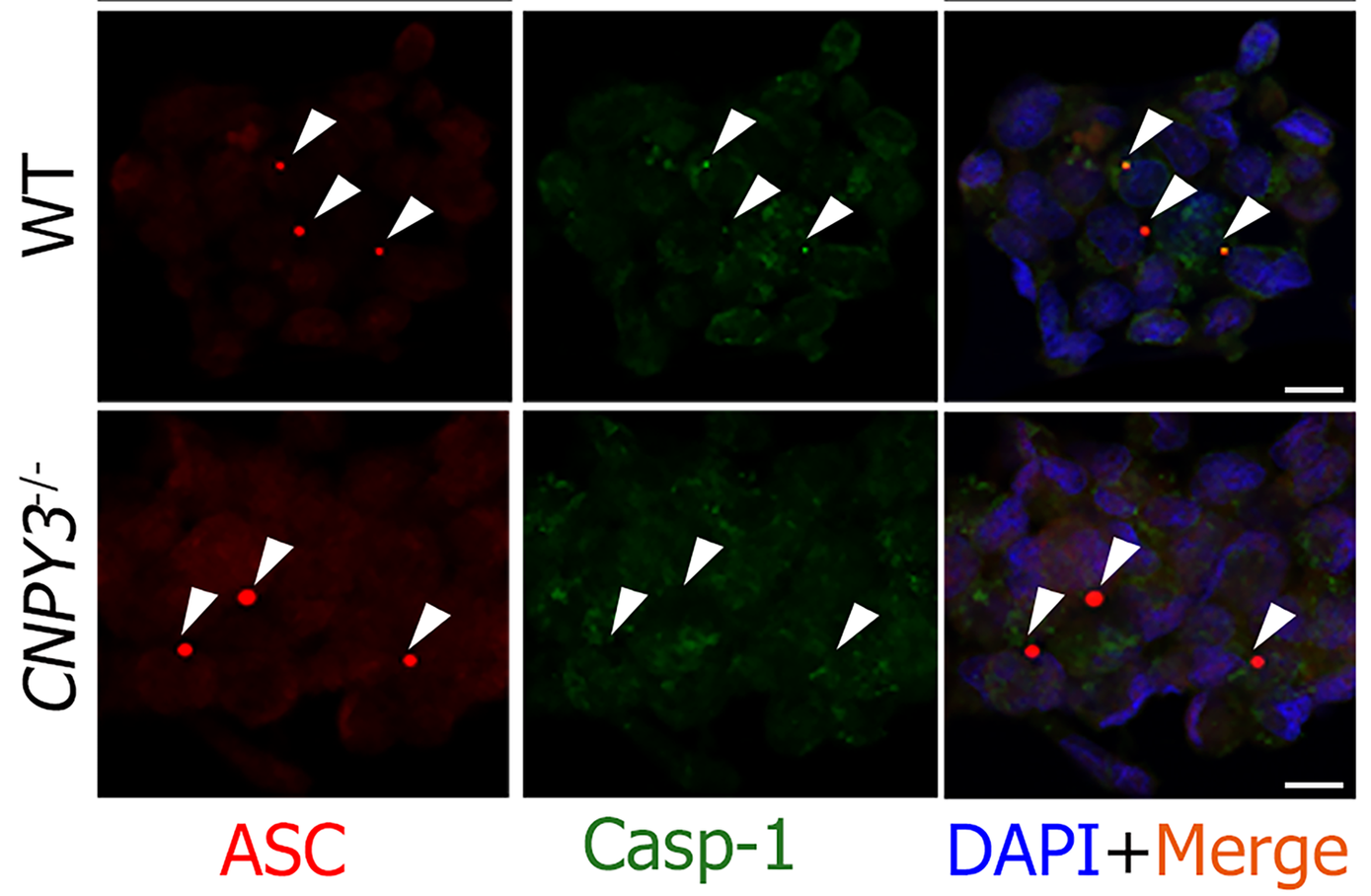 Bildung von Asc-Spots und gleichzeitige Rekrutierung von pro-Caspase-1 während der Aktivierung und des Aufbaus des Inflammasoms in Makrophagen. ASC- (rot) und Caspase-1-Protein (grün) in THP-1-Makrophagen nach dem Priming mit einem TLR3-Agonisten und der Stimulation mit Nigericin zur Aktivierung des kanonischen Inflammasoms. Die Rekrutierung von pro-Caspase-1 zu Asc-Specks war in THP1-Makrophagen mit CNPY3-Defizienz stark beeinträchtigt, was auf eine wesentliche Rolle des ER-residenten Chaperons CNPY3 beim Aufbau und der Aktivierung des Inflammasoms hinweist. Siehe Ghait et al. Eur J Immunol 2022.