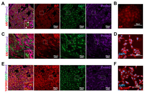 Expression of receptors for sex hormones and TGF-β1 in renal cortical tissue and TKPTS cells.
doi: 10.3390/cells9102236