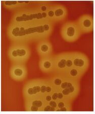 S. aureus colonies on a blood plate with large zones of hemolysis