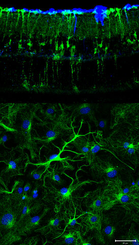 Müller glia EvB and Culture