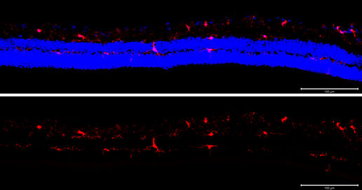 Microglia Tile scan Iba Dapi 100 mm