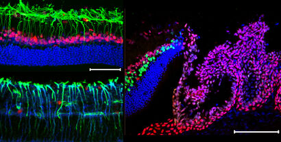 Retina CB diverse marker Kopie