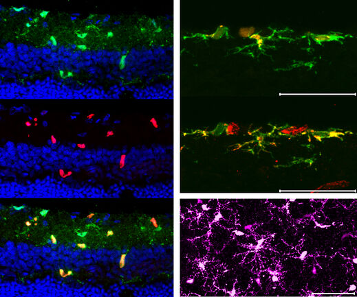 microglia schnitt + flat mount