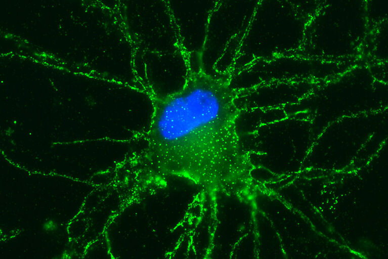 Dargestellt ist ein Neuron des Hippocampus eines Nagetiers, das in einer Zellkultur gezüchtet wurde. Ein rekombinanter Antikörper menschlichen Ursprungs, der sich gegen ein Oberflächenprotein des Neurons richtet, wurde mit einem grünen Farbstoff markiert. Dadurch leuchten die Stellen, an denen der Antikörper gebunden hat, grün. Der Zellkern des Neurons ist blau dargestellt.
© Leypoldt Labor, CAU Kiel