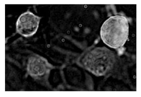 Abb. 1: Darstellung des membranständigen Bradykinin-Rezeptors 2 (Neurone 2 Tage in Kultur)