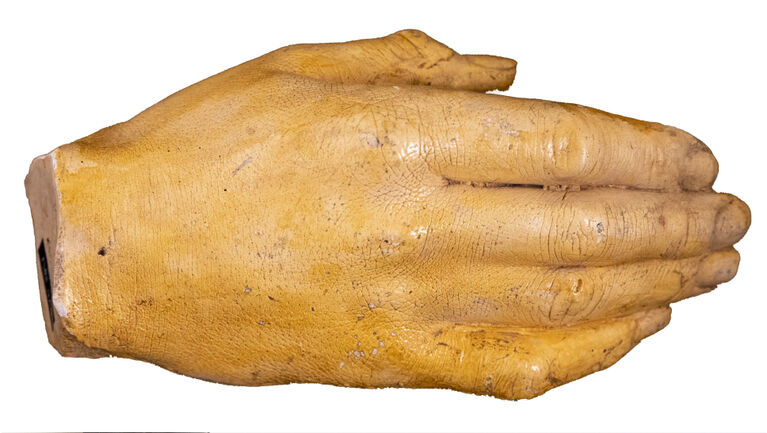 Lebendabguss aus Gips, 1. Hälfte des 20. Jahrhunderts. Foto: C. Redies, © Anatomische Sammlung, 2021.
