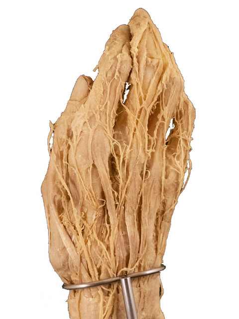 Plastiniertes Präparat (2007). Foto: C. Redies, © Anatomische Sammlung, 2021
