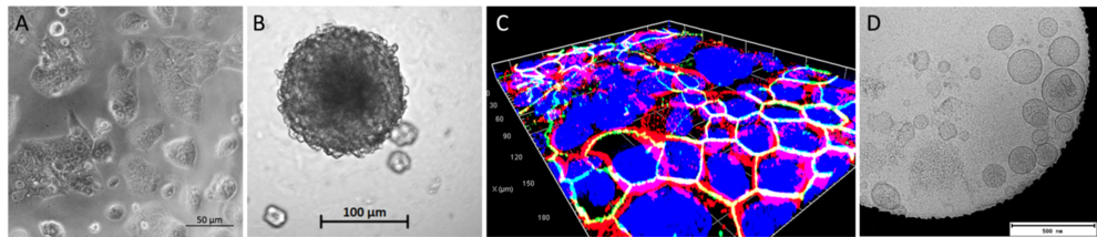 Trophoblast cells can be cultivated in A) monolayers growing on 2D culture, B) 3D spheroids C) or in microfluidic systems also known as placenta barrier on-chip.  Here, the green color shows the immunostaining of zona occludens protein 1 and the red color shows β-catenin protein in the trophoblastic cell line BeWo. The nuclei in blue were stained with DAPI (4′,6-diamidino-2-phenylindole).D) Extracellular vesicles secreted by trophoblast cells with size around 100 nm. 